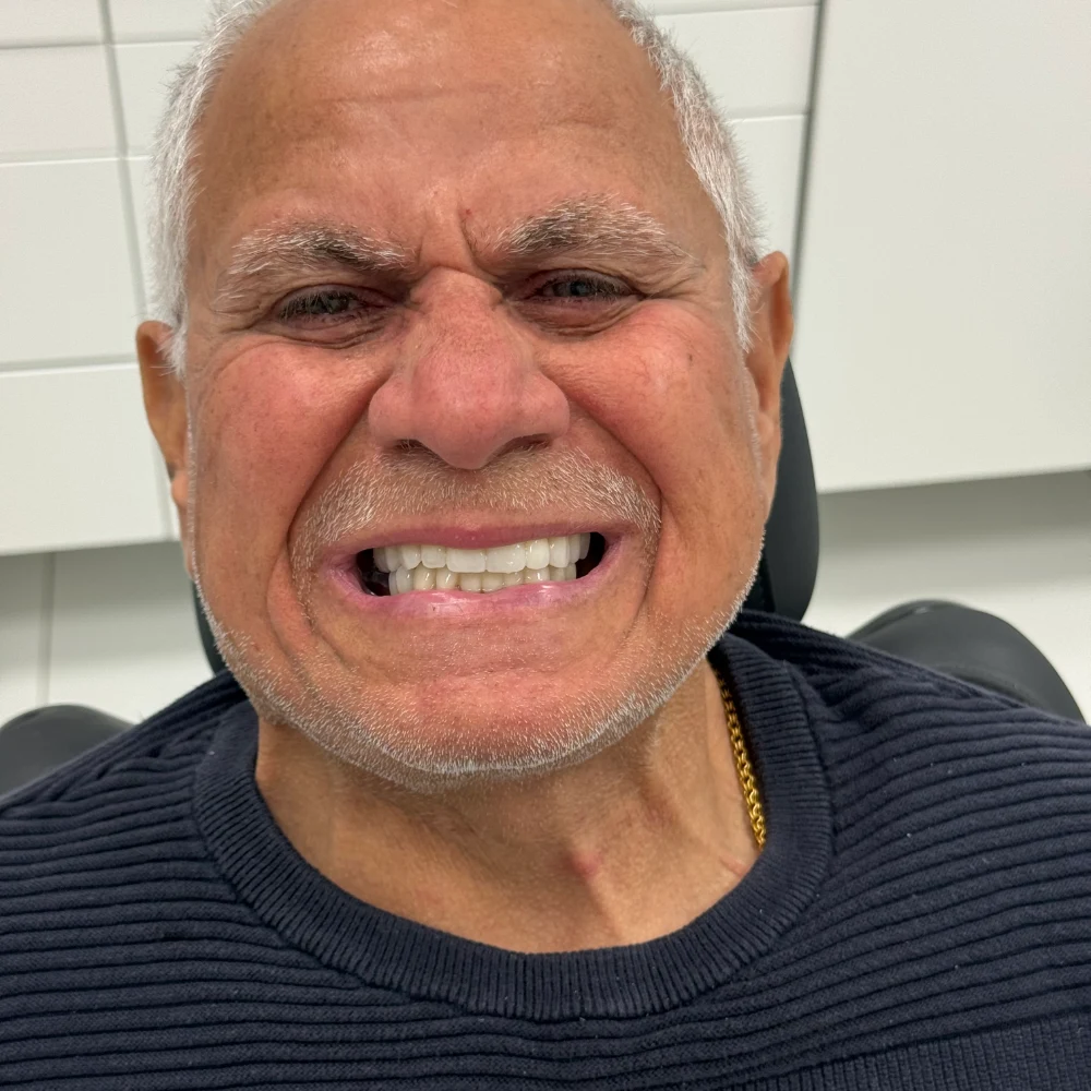 Efter implantatbehandling – XDental Norrköping