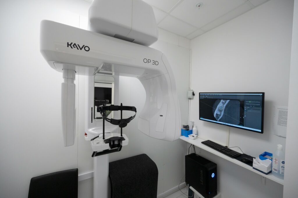 CBCT-maskin för 3D-röntgen på XDentals klinik